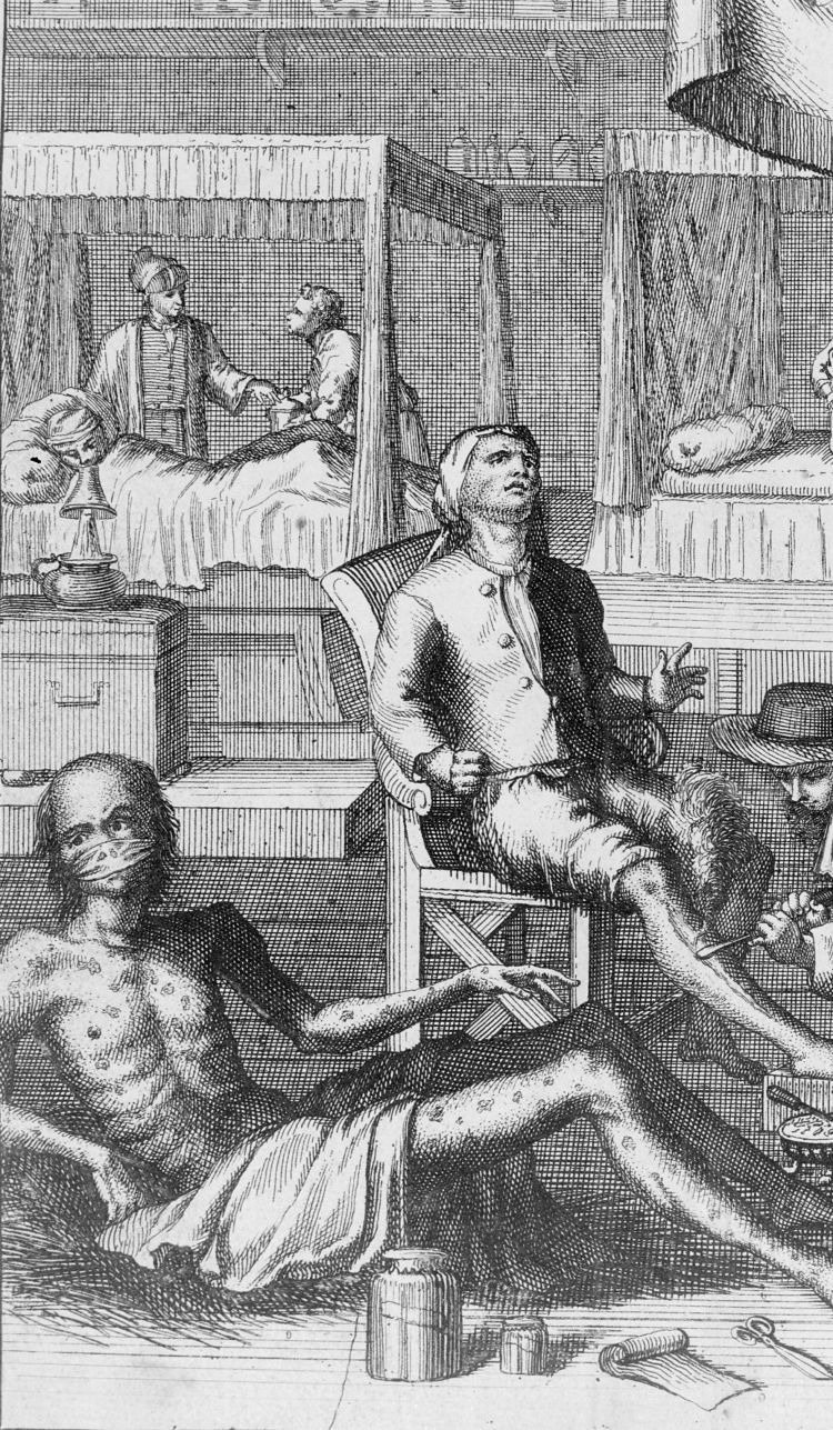 Exploring 19th Century Treatment for Syphilis: A Historical Perspective