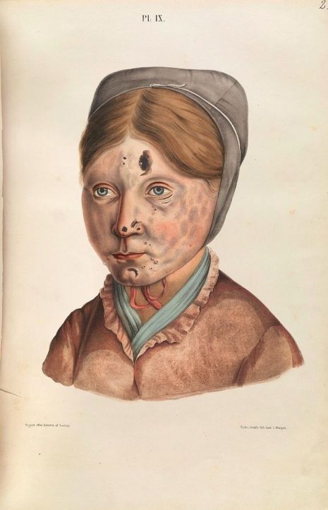 Exploring the Beauty and Science of 19th Century Vintage Medical Illustrations