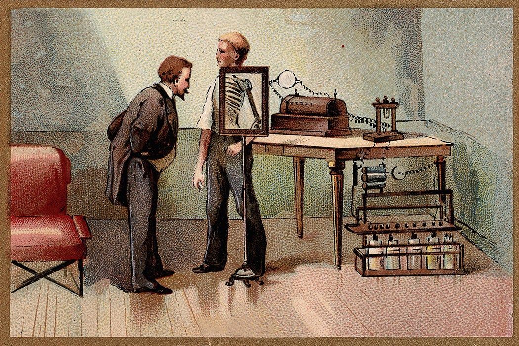 Revolutionizing Medicine: Exploring the Impact of 19th Century X-Rays